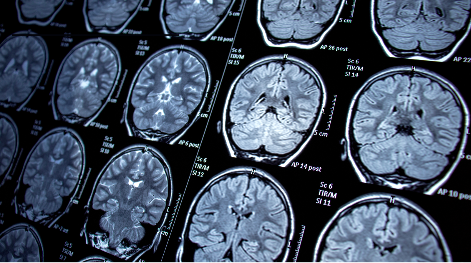 Neurology services maximum healthcare